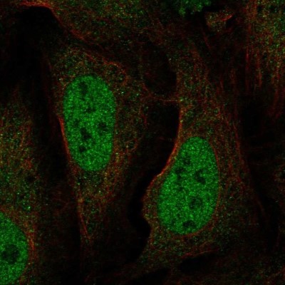 Immunocytochemistry/Immunofluorescence: BAAT1 Antibody [NBP2-57563] - Staining of human cell line U-2 OS shows localization to nucleoplasm.