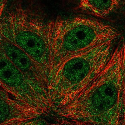 Immunocytochemistry/Immunofluorescence: TRIM65 Antibody [NBP2-57590] - Staining of human cell line MCF7 shows localization to nucleoplasm & cytosol.