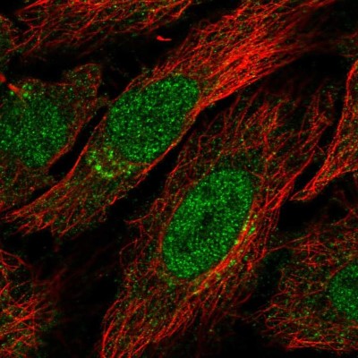 Immunocytochemistry/Immunofluorescence: CSB Antibody [NBP2-57574] - Staining of human cell line HeLa shows localization to nucleus & the Golgi apparatus.