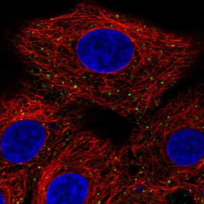 Immunocytochemistry/Immunofluorescence: ANKFY1 Antibody [NBP2-57520] - Staining of human cell line A549 shows localization to endosomes.