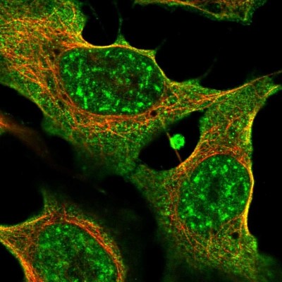 Immunocytochemistry/Immunofluorescence: Thrombospondin-2 Antibody [NBP2-58202] - Staining of human cell line U-2 OS shows localization to nuclear speckles & plasma membrane.