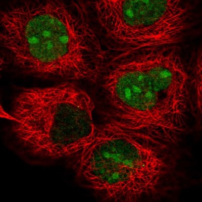 Immunocytochemistry/Immunofluorescence: TYW1 Antibody [NBP2-58222] - Staining of human cell line A-431 shows localization to nucleus & nucleoli.