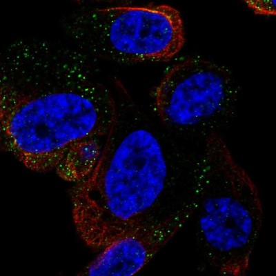 Immunocytochemistry/Immunofluorescence: HACL1 Antibody [NBP2-58018] - Staining of human cell line PC-3 shows localization to vesicles.