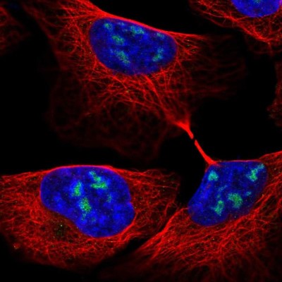 Immunocytochemistry/Immunofluorescence: RBM28 Antibody [NBP2-54998] - Staining of human cell line U-2 OS shows localization to nucleoli.