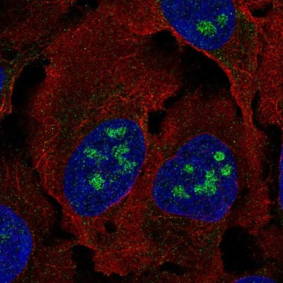 Immunocytochemistry/Immunofluorescence: BLCAP Antibody [NBP2-54983] - Staining of human cell line U-2 OS shows localization to nucleoli.