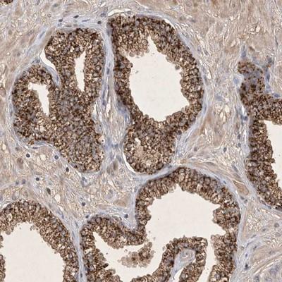 Immunohistochemistry: C9orf128 Antibody [NBP1-91050] - Staining of human prostate shows strong granular cytoplasmic positivity in glandular cells.