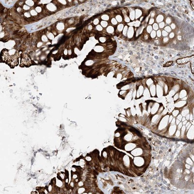 Immunohistochemistry-Paraffin: BCORL1 Antibody [NBP1-90607] - Staining of human colon shows strong cytoplasmic and membranous positivity in glandular cells.