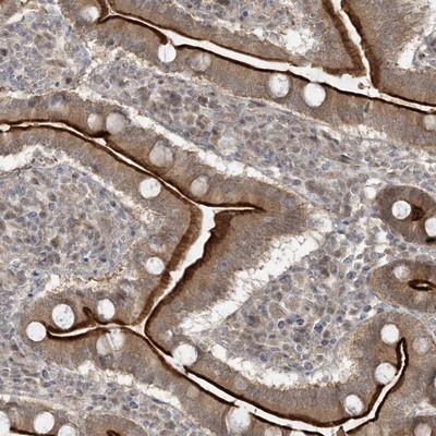 Immunohistochemistry-Paraffin: BCORL1 Antibody [NBP1-90608] - Staining of human duodenum shows strong luminal membranous positivity in glandular cells.