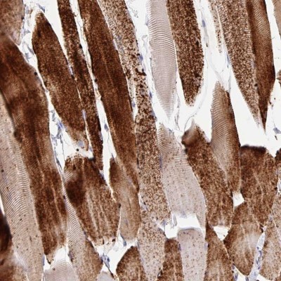 Immunohistochemistry: Glycogen phosphorylase, muscle form Antibody [NBP2-49209] - Staining of human skeletal muscle shows strong cytoplasmic positivity in myocytes.