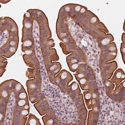 Immunohistochemistry: C14orf79 Antibody [NBP2-49324] - Staining of human small intestine shows strong cytoplasmic and membranous positivity in glandular cells.