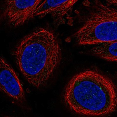 Immunocytochemistry/Immunofluorescence: LEPROT Antibody [NBP2-57596] - Staining of human cell line SiHa shows localization to centrosome.