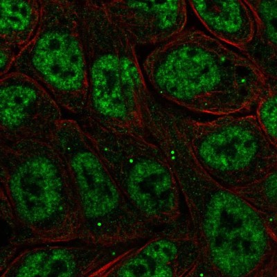 Immunocytochemistry/Immunofluorescence: IKB zeta Antibody [NBP2-57948] - Staining of human cell line RT4 shows localization to nuclear speckles & cytoplasmic bodies.