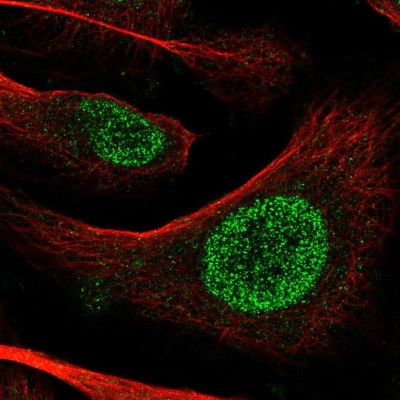 Immunocytochemistry/Immunofluorescence: POT1 Antibody [NBP2-57891] - Staining of human cell line U-2 OS shows localization to nucleoplasm.