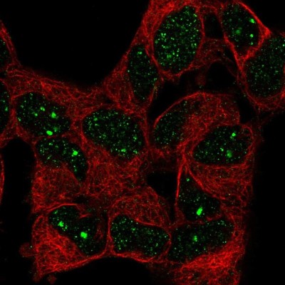 Immunocytochemistry/Immunofluorescence: WSTF Antibody [NBP2-57741] - Staining of human cell line SH-SY5Y shows localization to nuclear bodies.