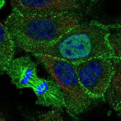 Immunocytochemistry/Immunofluorescence: C1orf172 Antibody [NBP2-57750] - Staining of human cell line A-431 shows localization to nucleoplasm, mitotic spindle & cell junctions.
