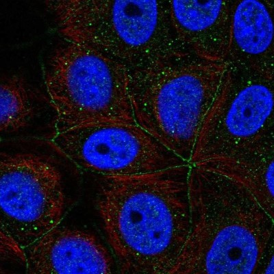 Immunocytochemistry/Immunofluorescence: PCDHA11 Antibody [NBP2-57691] - Staining of human cell line MCF7 shows localization to cell junctions & vesicles.