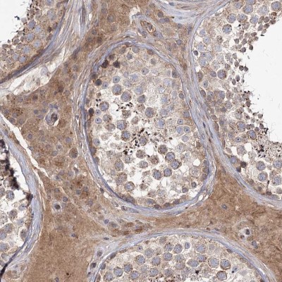 Immunohistochemistry-Paraffin: C5orf36 Antibody [NBP2-38379] - Staining of human testis shows moderate cytoplasmic positivity in Leydig cells.