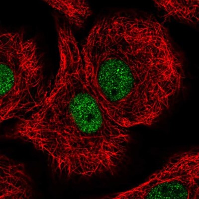 Immunocytochemistry/Immunofluorescence: DDB1 Antibody [NBP2-57877] - Staining of human cell line A549 shows localization to nucleoplasm.