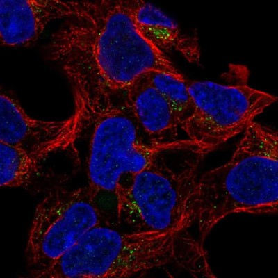 Immunocytochemistry/Immunofluorescence: GALNT8 Antibody [NBP2-57906] - Staining of human cell line HEK 293 shows localization to vesicles.