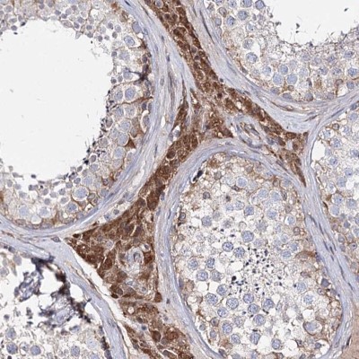 Immunohistochemistry-Paraffin: C5orf36 Antibody [NBP1-88257] - Staining of human testis shows strong cytoplasmic positivity in Leydig cells.