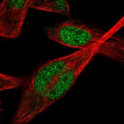 Immunocytochemistry/Immunofluorescence: IPMK Antibody [NBP2-57192] - Staining of human cell line RH-30 shows localization to nucleoplasm.
