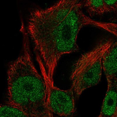 Immunocytochemistry/Immunofluorescence: ITPKB Antibody [NBP2-57395] - Staining of human cell line SK-MEL-30 shows localization to nucleoplasm.
