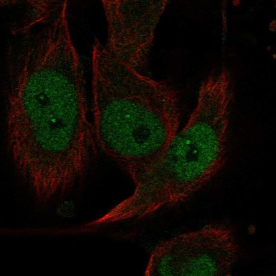 Immunocytochemistry/Immunofluorescence: EVI2A Antibody [NBP2-55341] - Staining of human cell line U-251 MG shows localization to nucleoplasm.