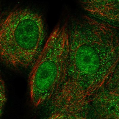 Immunocytochemistry/Immunofluorescence: Rad51C Antibody [NBP2-55278] - Staining of human cell line MCF7 shows localization to nucleoplasm, mitochondria & cell junctions.