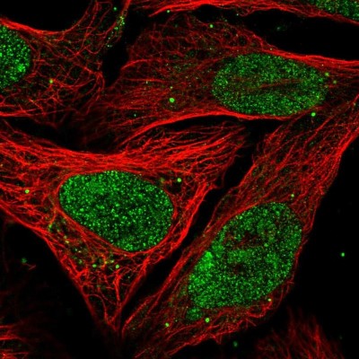 Immunocytochemistry/Immunofluorescence: PELP1 Antibody [NBP2-58736] - Staining of human cell line U-2 OS shows localization to nucleus & nucleoli.