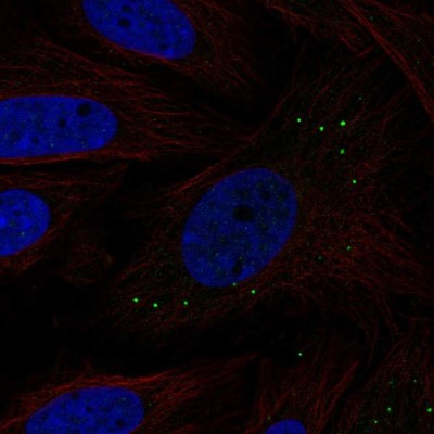 Immunocytochemistry/Immunofluorescence: GNPTAB Antibody [NBP2-55327] - Staining of human cell line SiHa shows localization to vesicles.