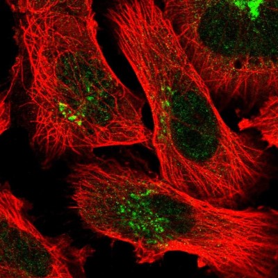 Immunocytochemistry/Immunofluorescence: C9orf25 Antibody [NBP2-55649] - Staining of human cell line U-251 MG shows localization to the Golgi apparatus.