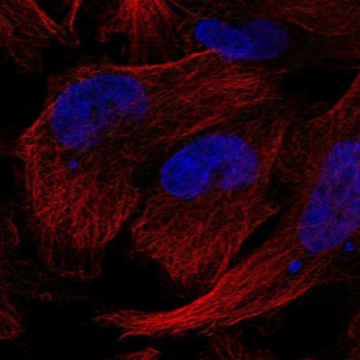 Immunocytochemistry/Immunofluorescence: Gemin 5 Antibody [NBP2-58136] - Staining of human cell line U-251 MG shows no positivity.