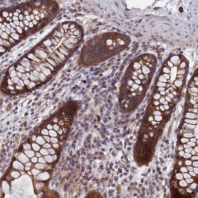 Immunohistochemistry: C20orf144 Antibody [NBP2-14398] - Staining of human colon shows strong cytoplasmic and nuclear positivity in glandular cells.