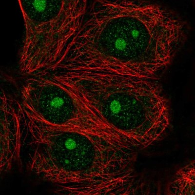 Immunocytochemistry/Immunofluorescence: IMP4 Antibody [NBP2-55739] - Staining of human cell line MCF7 shows localization to nucleoli.