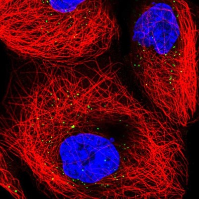 Immunocytochemistry/Immunofluorescence: TRUB1 Antibody [NBP2-55729] - Staining of human cell line A-431 shows localization to vesicles.