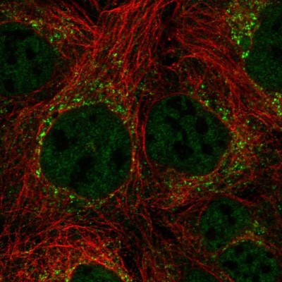 Immunocytochemistry/Immunofluorescence: MIS RII/AMHR2 Antibody [NBP2-55819] - Staining of human cell line CACO-2 shows localization to nucleoplasm & vesicles.