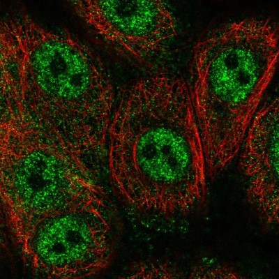 Immunocytochemistry/Immunofluorescence: CASKIN2 Antibody [NBP2-55768] - Staining of human cell line MCF7 shows localization to nucleoplasm.