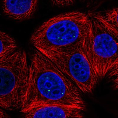 Immunocytochemistry/Immunofluorescence: TH1L Antibody [NBP2-55741] - Staining of human cell line MCF7 shows localization to nuclear bodies.