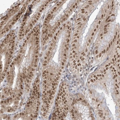 Immunohistochemistry: LCoR Antibody [NBP2-37869] - Staining of human stomach, lower shows moderate nuclear positivity in glandular cells.