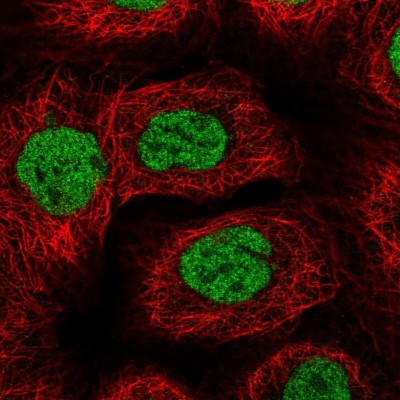 Immunocytochemistry/Immunofluorescence: BACH1 Antibody [NBP2-55113] - Staining of human cell line A-431 shows localization to nucleoplasm.