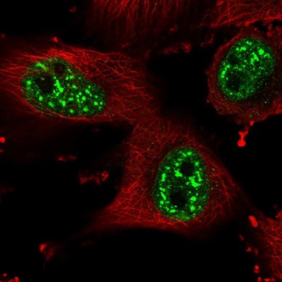 Immunocytochemistry/Immunofluorescence: HP1BP3 Antibody [NBP2-55069] - Staining of human cell line U-251 MG shows localization to nuclear speckles.