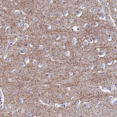 Immunohistochemistry-Paraffin: Synaptoporin Antibody [NBP2-13405] Staining of human cerebral cortex shows moderate granular positivity in neuropil.