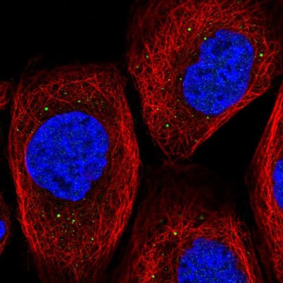 Immunocytochemistry/Immunofluorescence: TIPRL Antibody [NBP2-55024] - Staining of human cell line A-431 shows localization to vesicles.