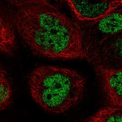 Immunocytochemistry/Immunofluorescence: PALB2 Antibody [NBP2-55028] - Staining of human cell line A-431 shows localization to nucleoplasm.