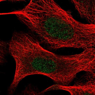 Immunocytochemistry/Immunofluorescence: TIA1 Antibody [NBP2-54962] - Staining of human cell line U-2 OS shows localization to nucleoplasm.