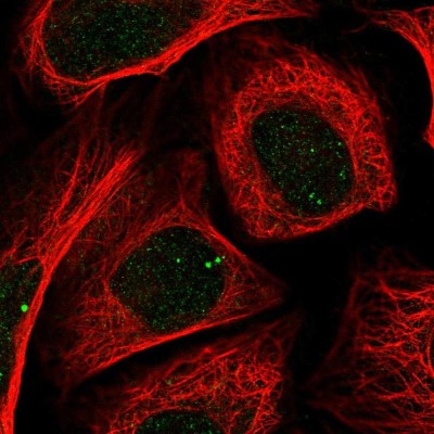 Immunocytochemistry/Immunofluorescence: Zic2 Antibody [NBP2-55066] - Staining of human cell line U-2 OS shows localization to nuclear bodies.