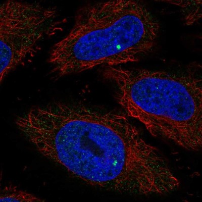 Immunocytochemistry/Immunofluorescence: RIBC1 Antibody [NBP2-55264] - Staining of human cell line HeLa shows localization to nuclear bodies.