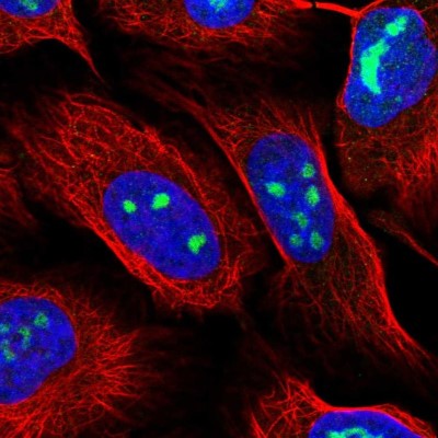 Immunocytochemistry/Immunofluorescence: WDR3 Antibody [NBP2-55478] - Staining of human cell line U-2 OS shows localization to nucleus & nucleoli.