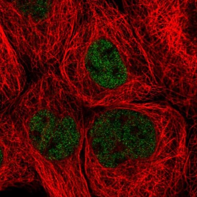 Immunocytochemistry/Immunofluorescence: ZHX3 Antibody [NBP2-55486] - Staining of human cell line A-431 shows localization to nucleoplasm.