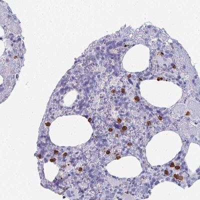 Immunohistochemistry: C13orf18 Antibody [NBP2-49134] - Staining of human bone marrow shows strong cytoplasmic positivity in hematopoietic cells.